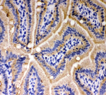 Anti-E Cadherin 1/CDH1 Antibody