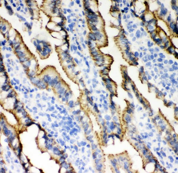 Anti-E Cadherin 1/CDH1 Antibody