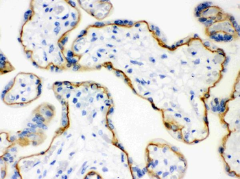 Anti-E Cadherin 1/CDH1 Antibody