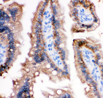 Anti-E Cadherin 1/CDH1 Antibody
