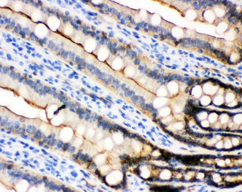 Anti-E Cadherin 1/CDH1 Antibody