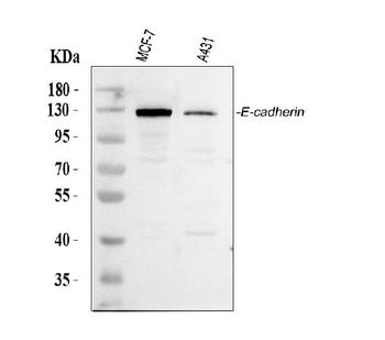 Anti-E Cadherin 1/CDH1 Antibody