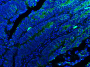 Anti-E Cadherin 1/CDH1 Antibody