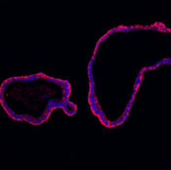 Anti-E Cadherin 1/CDH1 Antibody