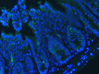 Anti-E Cadherin 1/CDH1 Antibody