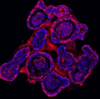 Anti-E Cadherin 1/CDH1 Antibody