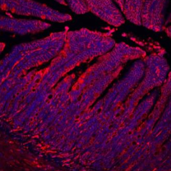 Anti-E Cadherin 1/CDH1 Antibody