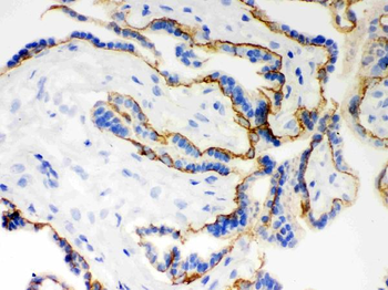 Anti-E Cadherin 1/CDH1 Antibody