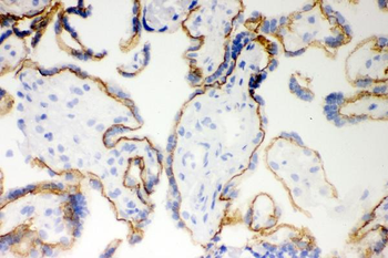 Anti-E Cadherin 1/CDH1 Antibody