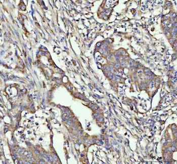 Anti-G-CSF/CSF3 Antibody