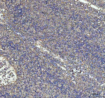 Anti-G-CSF/CSF3 Antibody