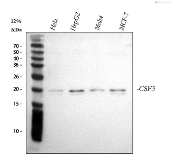Anti-G-CSF/CSF3 Antibody