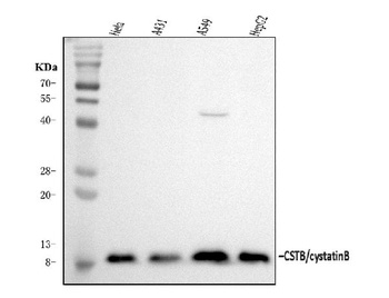 Stefin B/CSTB Antibody