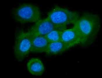 Anti-Stefin B/CSTB Antibody