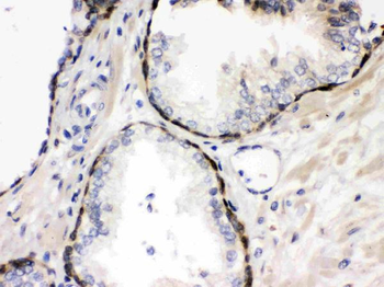 Anti-Stefin B/CSTB Antibody