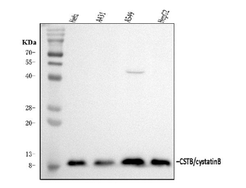 Anti-Stefin B/CSTB Antibody