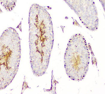 Anti-DMRT1 Antibody