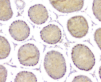 Anti-DMRT1 Antibody