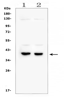 Anti-DMRT1 Antibody
