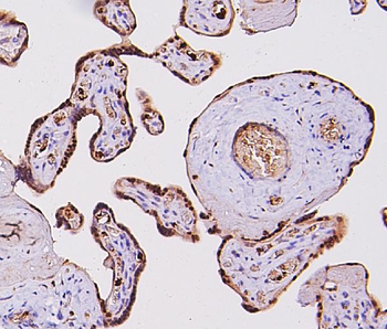 Anti-Fos B/FOSB Antibody