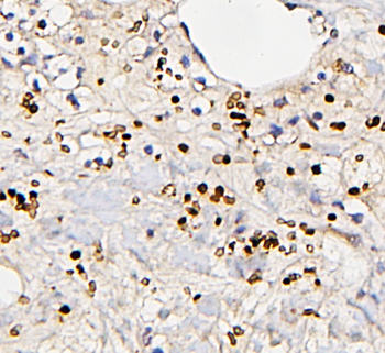 Anti-Fos B/FOSB Antibody