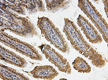 Anti-Fos B/FOSB Antibody