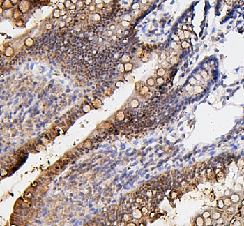 Anti-Fos B/FOSB Antibody