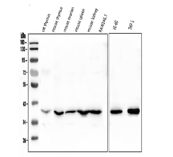 Anti-Fos B/FOSB Antibody