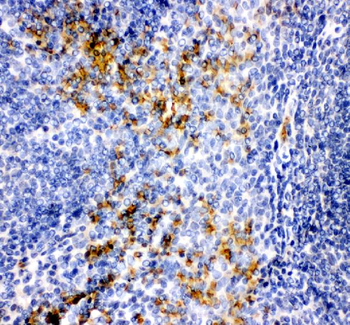 Anti-MCP1/CCL2 Antibody