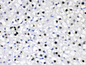 Anti-CRY2 Antibody