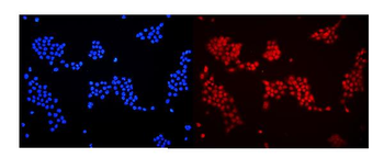 Anti-DDB1 Antibody