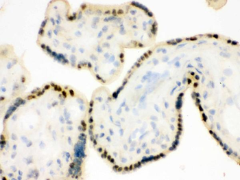 Anti-DDB1 Antibody