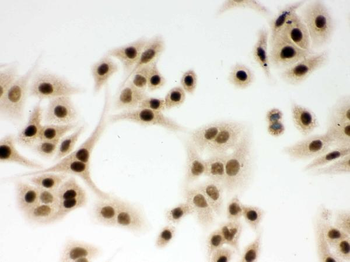 Anti-DDB1 Antibody
