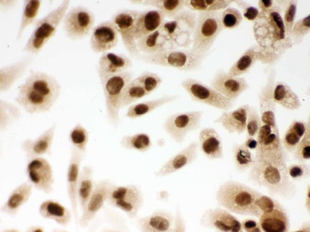 Anti-DDB1 Antibody