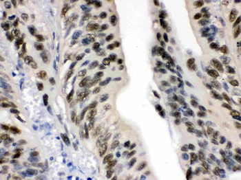 Anti-DDB1 Antibody