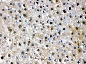 Anti-DDB1 Antibody
