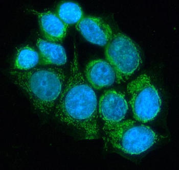 Anti-Lipoamide Dehydrogenase/DLD Antibody
