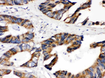 Anti-Lipoamide Dehydrogenase/DLD Antibody
