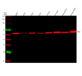 Anti-Lipoamide Dehydrogenase/DLD Antibody