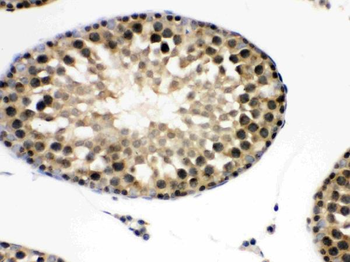 Anti-integrin beta 4 binding protein/EIF6 Antibody