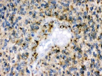 Anti-Eph receptor B1/EPHB1 Antibody
