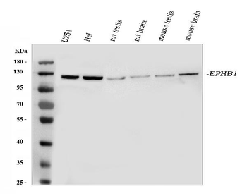 Anti-Eph receptor B1/EPHB1 Antibody