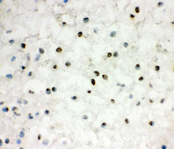 Anti-EWSR1 Antibody
