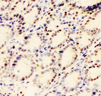Anti-EWSR1 Antibody