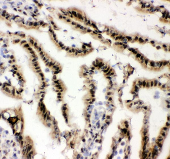 Anti-EWSR1 Antibody