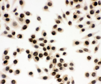 Anti-EWSR1 Antibody