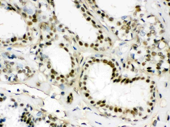 Anti-EWSR1 Antibody