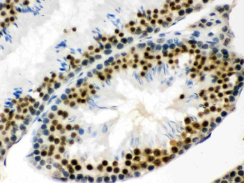 Anti-EWSR1 Antibody