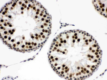 Anti-EWSR1 Antibody