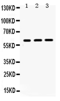 HNF1 beta/HNF1B Antibody